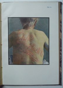 Erkennung der Geistesstörungen (Psychiatrische Diagnostik)
