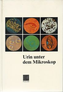 Urin unter dem Mikroskop