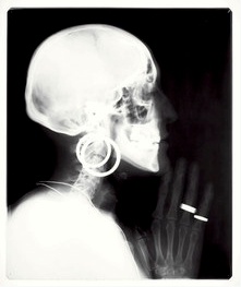 Meret Oppenheim