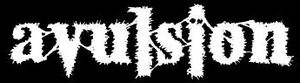 Avulsion