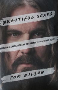 Beautiful Scars