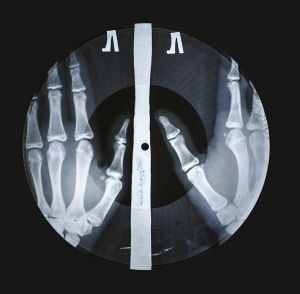 X Ray Audio - The Strange Story Of Soviet Music On The Bone