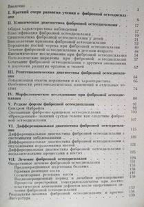 Фиброзная остеодисплазия