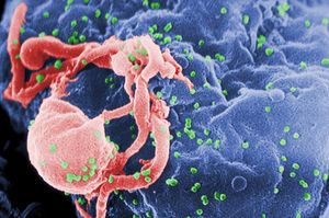 HIV