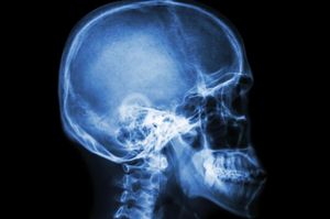 X-Ray