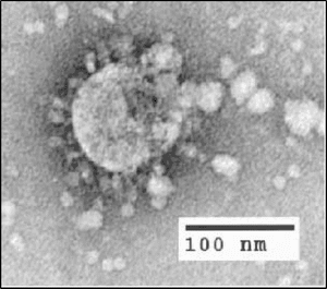 SARS (Severe Acute Respiratory Syndrome)