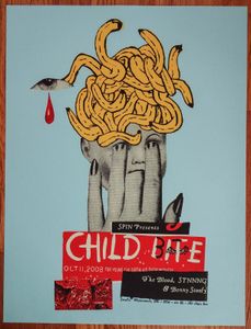 Child Bite 2008 Hamtramck, MI