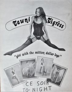 Girl With The Million Dollar Legs