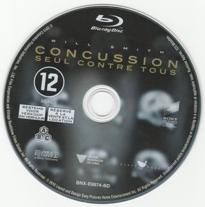 Concussion