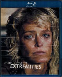 Extremities
