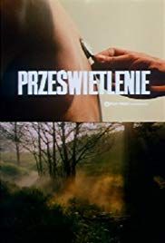 Prześwietlenie