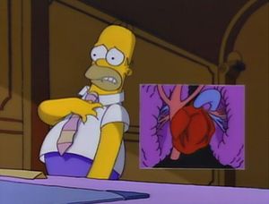 Homer's Triple Bypass