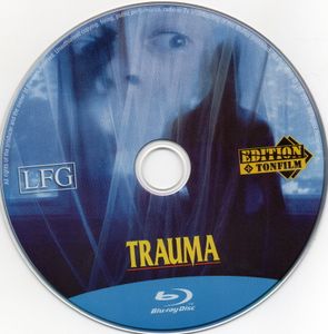 Trauma
