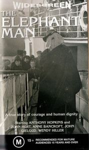 the elephant man