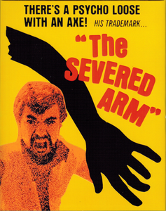 The Severed Arm