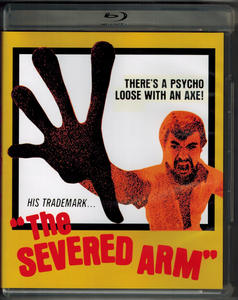 The Severed Arm