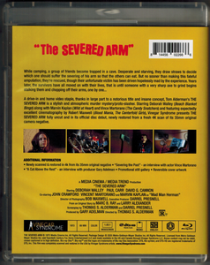 The Severed Arm