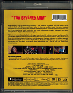 The Severed Arm