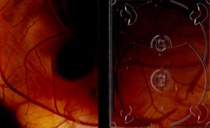The Tree of Life (The Criterion Collection)